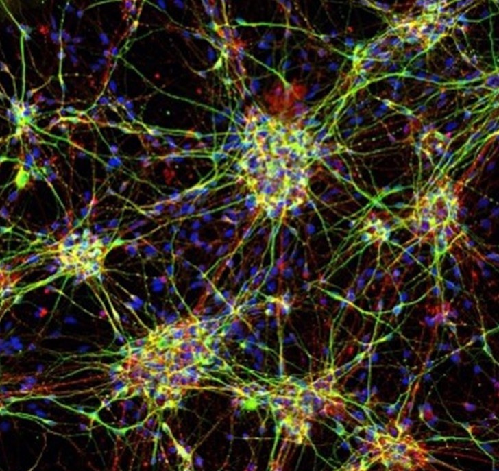 Stem cell-derived neurons from a four-year-old child with a mutation in the SCN2A gene causing epileptic encephalopathy