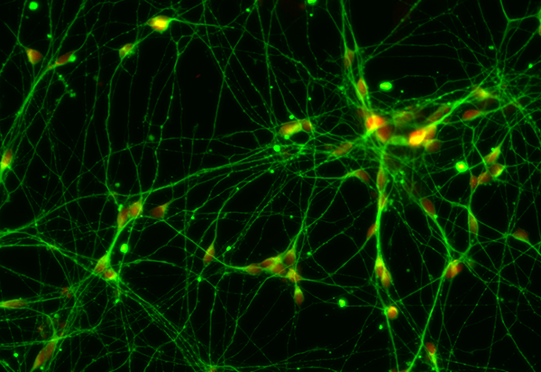 Motor neurones grown in the laboratory