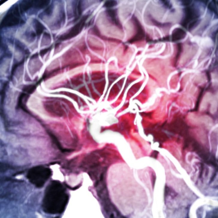 An unexpected find opens a new way to regulate blood pressure