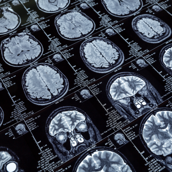 How does COVID affect the brain? The Florey Institute’s Clinical Director and Director explain