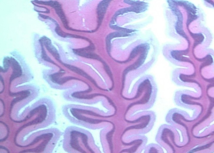 Histological slide of brain tissue using purple and blue dye