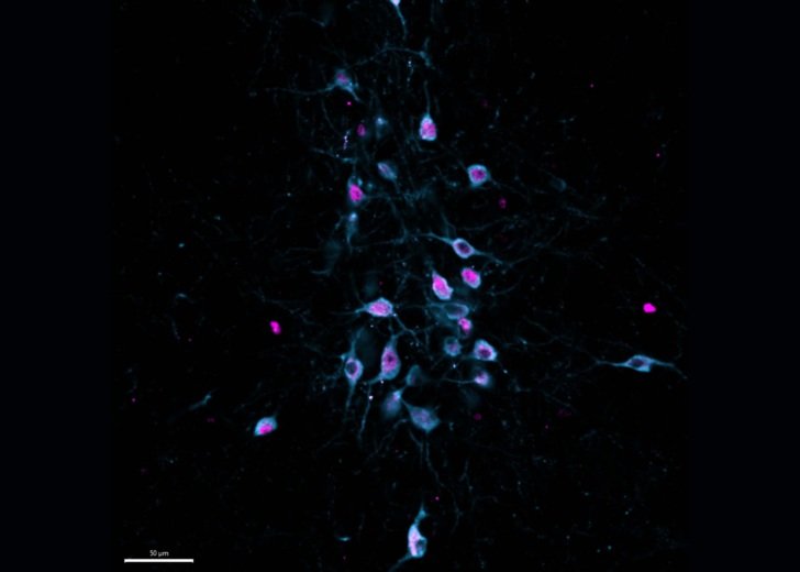 The Edinger-Westphal nucleus of a mouse - CART neuropeptide shown in cyan and c-Fos positive cells shown in magenta. Credit: Kade Huckstep.