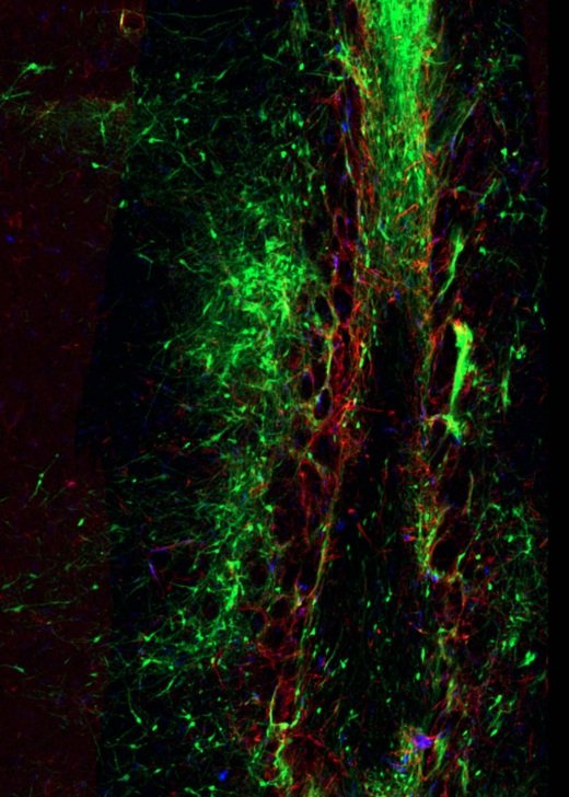Human iPSC-derived dopaminergic neurons transplanted into the neonatal rat striatum with a PITX3-EGFP reporter (green). Image also shows microglia (blue) and astrocytes (GFAP; red). Credit: Tyra Fraser.