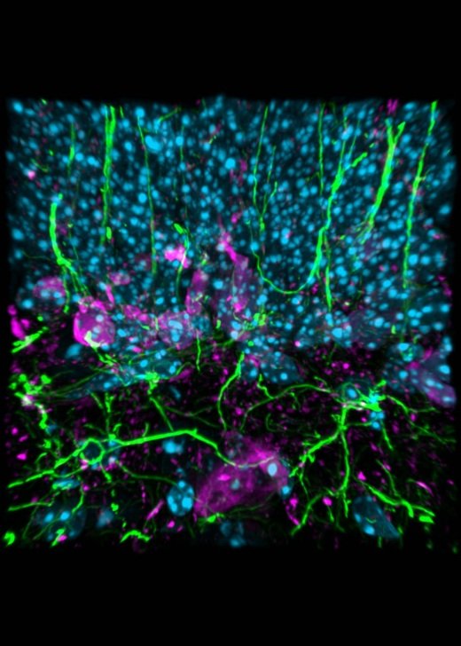 Neurons in the mouse cortex stained for calretinin (magenta), DAPI (blue) and GFAP (Glial fibrillary acidic protein, green). Credit: Dr Alita Soch.