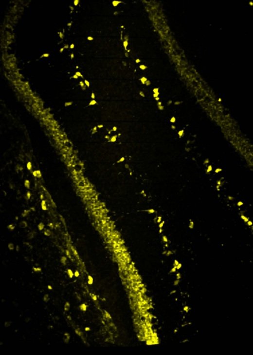 Calretinin positive neurons in the mouse hippocampus. Credit: Dr Alita Soch.