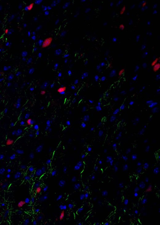 Mouse brain section stained with MAP2 (microtubule associated protein 2, green), nuclei (blue) and VIP (vasoactive intestinal peptide, red). Credit: Dr Carolina Chavez.