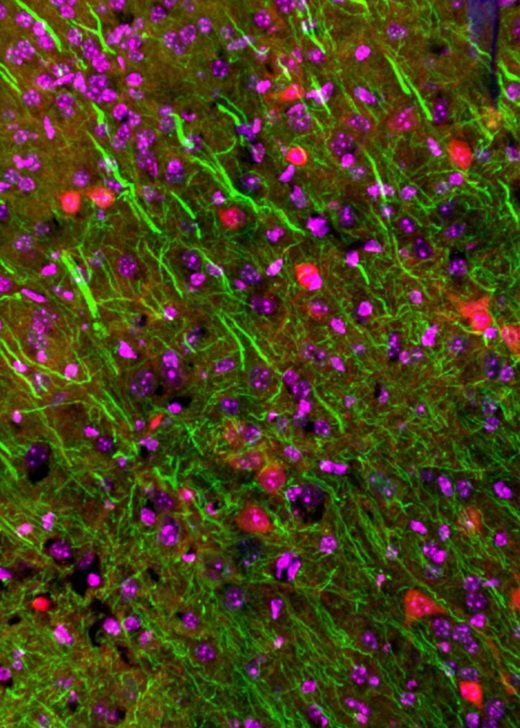 Mouse brain section stained with MAP2 (microtubule associated protein 2, green), nuclei (magenta) and VIP (vasoactive intestinal peptide, red). Credit: Dr Carolina Chavez.