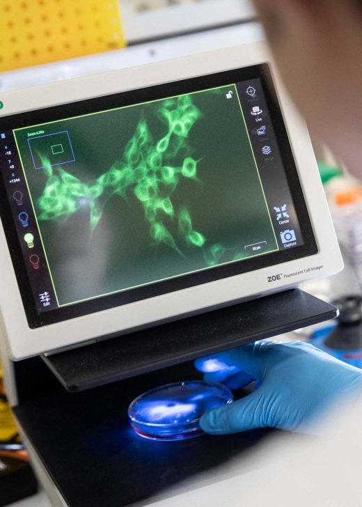 Researcher examines a green cell culture on a screen