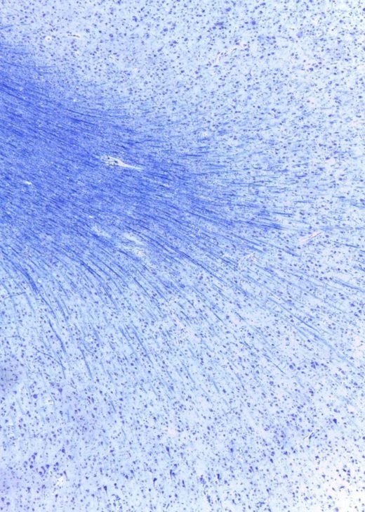 Microscopic image of myelin dyed blue