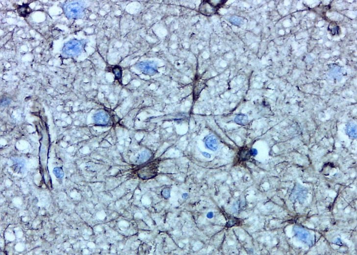 Brain astrocytes labelled with an antibody to glial fibrillary acidic protein. Magnification 800x.