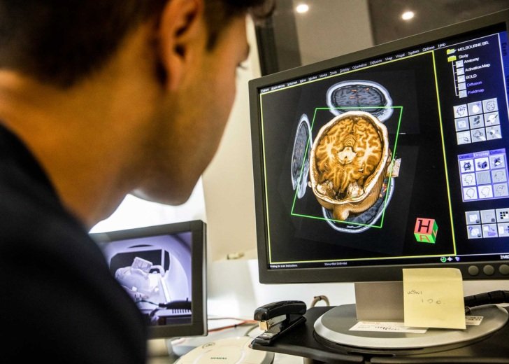 Researcher looking at a brain scan on a computer screen