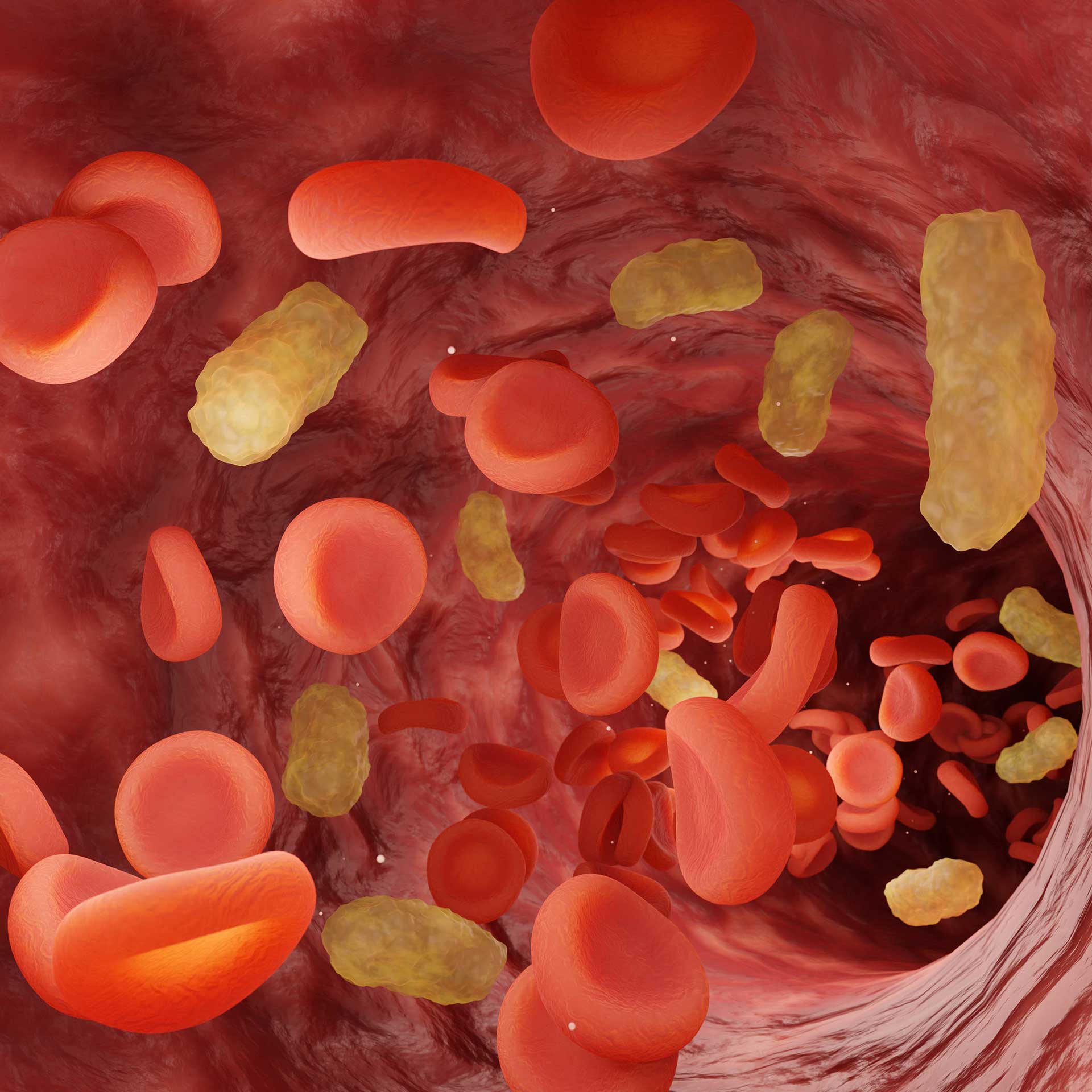 Research By PhD Student Leads To Rapid Clearance Of Sepsis In   Bacteria In Blood Stream 