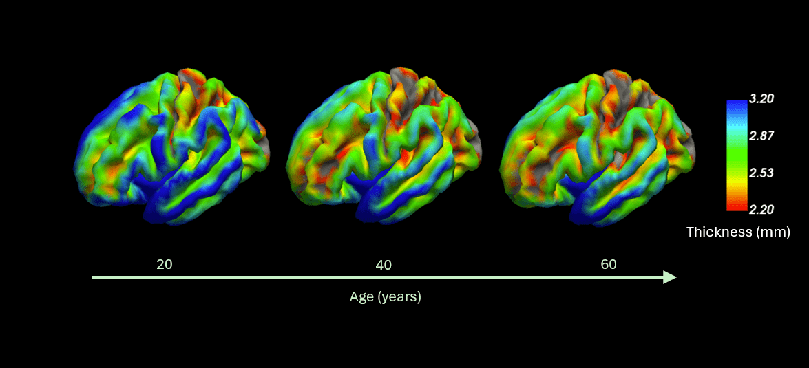 Neuroimage of brain ageing