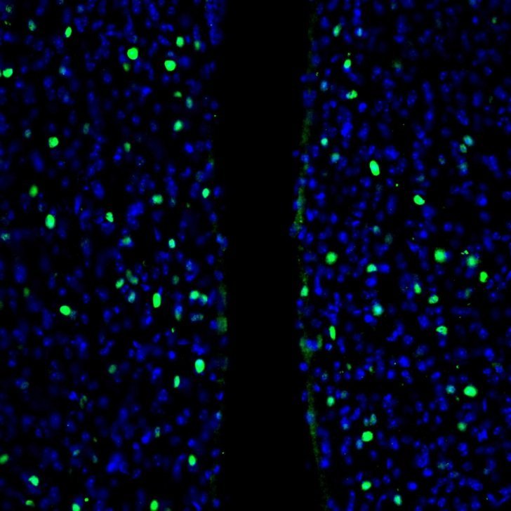 Bright cells meeting at the river of the ventricle – Florey microscopy imagery