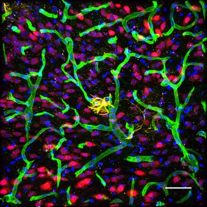 Can trapped drugs escape blood vessels to reach neurons? – Florey microscopy imagery