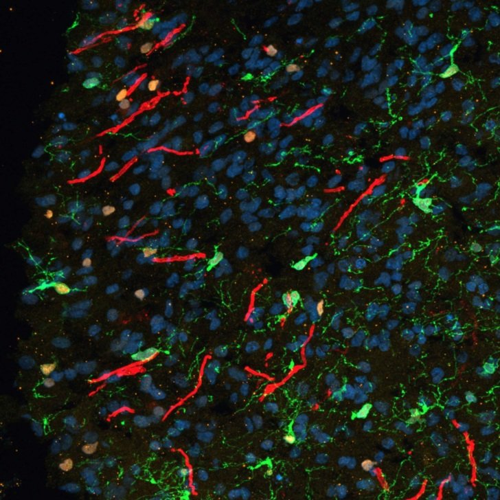 Jackson Pollock (reborn) – Florey microscopy imagery