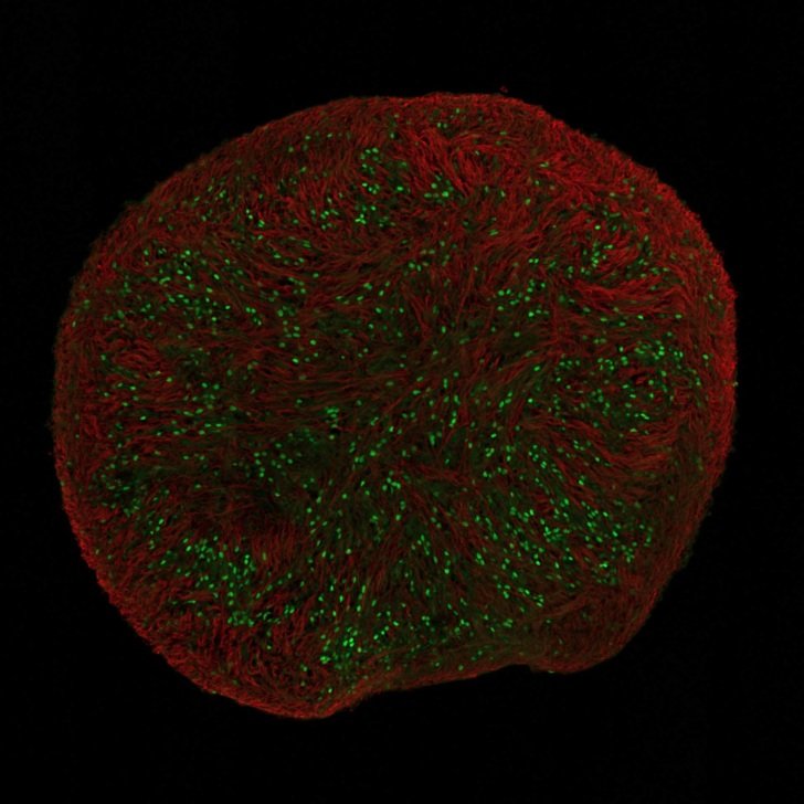 Overview of a spinal cord organoid – Florey microscopy imagery