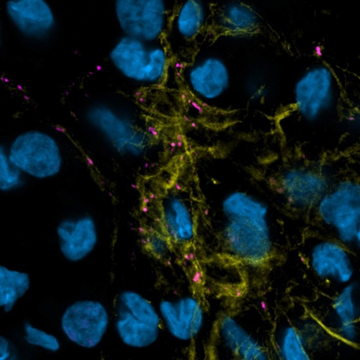 Synaptic transmission in brain organoids – Florey microscopy imagery