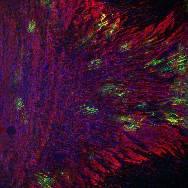 Bundle of Nerves (Just Like Me)