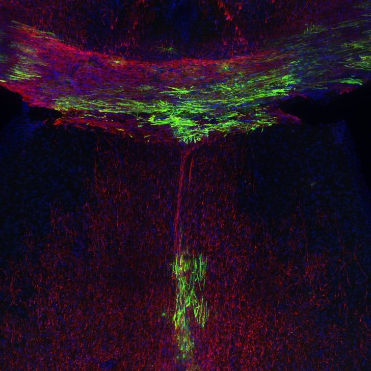 Helping Neurons Reach their Potential and Go the Distance