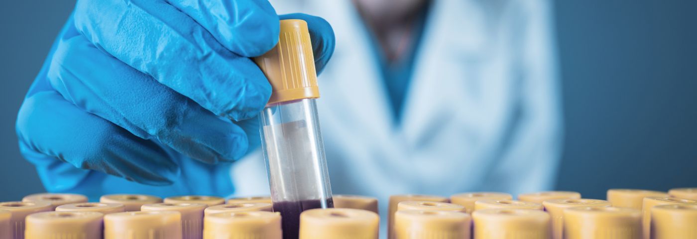 A researcher wearing blue gloves holds a test tube with fluid.