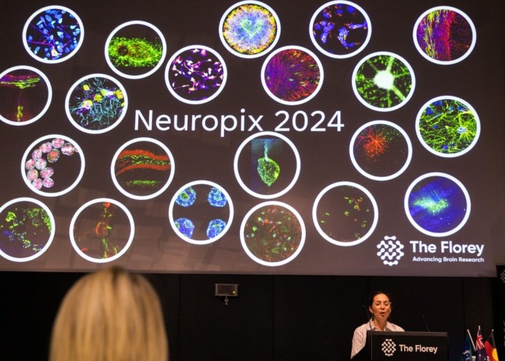 Neuropix presentation 2024 Florey Awards