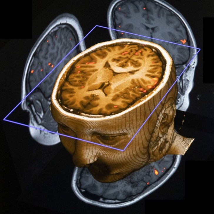 What connects a toothbrush, an MRI and brain surgery