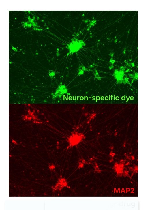 iNeurons drug-screening