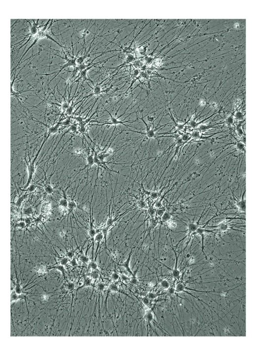 iPSC-derived neurons