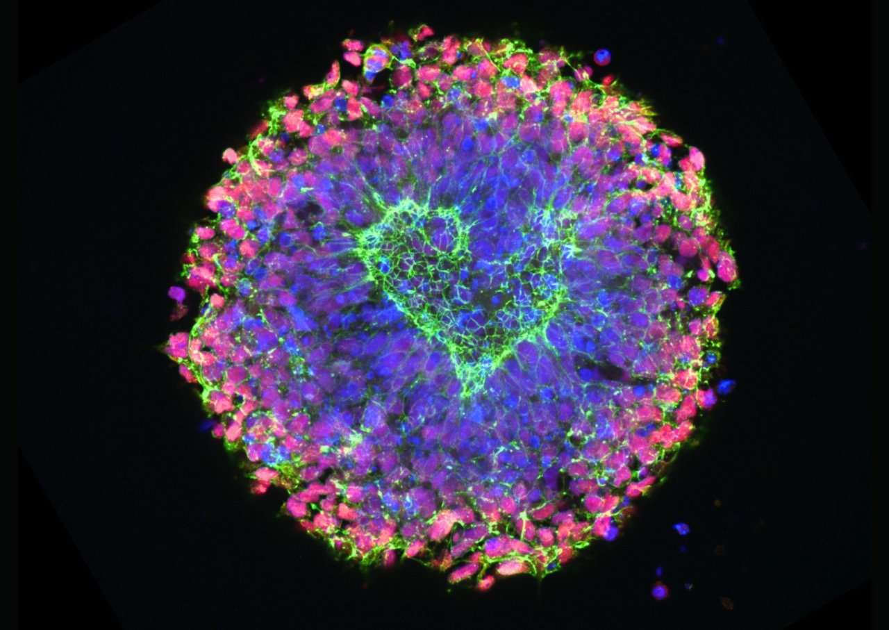 Neural Love, microscopy image of stem cells with its centre shaped like a green heart