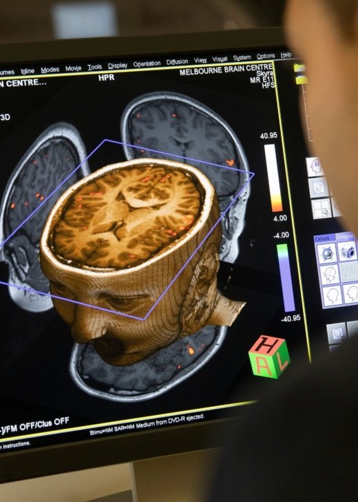 Florey Epilepsy and Neurodevelopment Research Priority