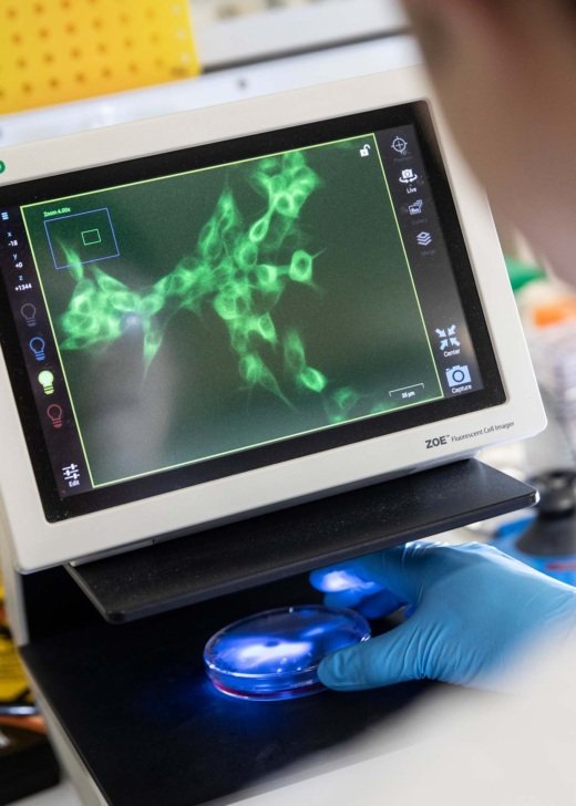 Florey Neurodegeneration and Immunology Research Priority