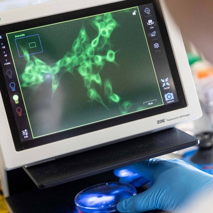 Neurodegeneration and Immunology Research Priority