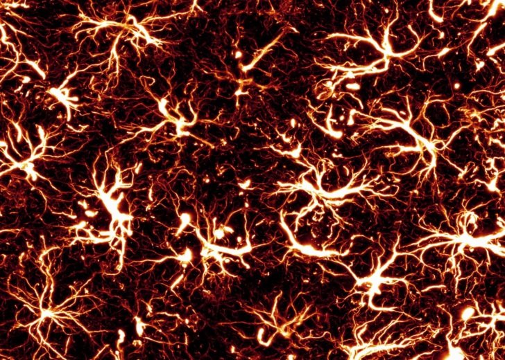 Neuropix 2025 People’s Choice Winner