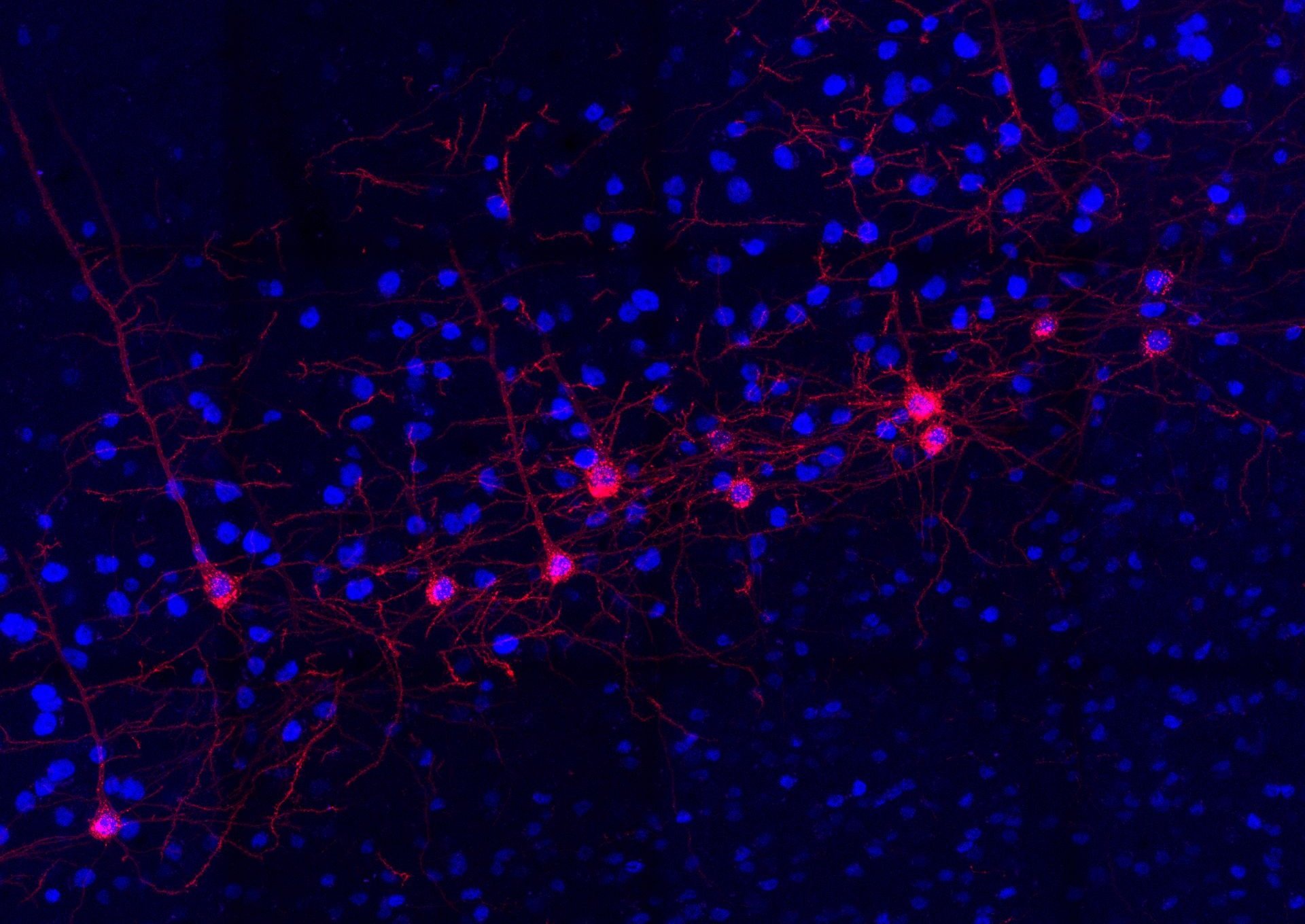 Brain motor neurons expressing DREADD