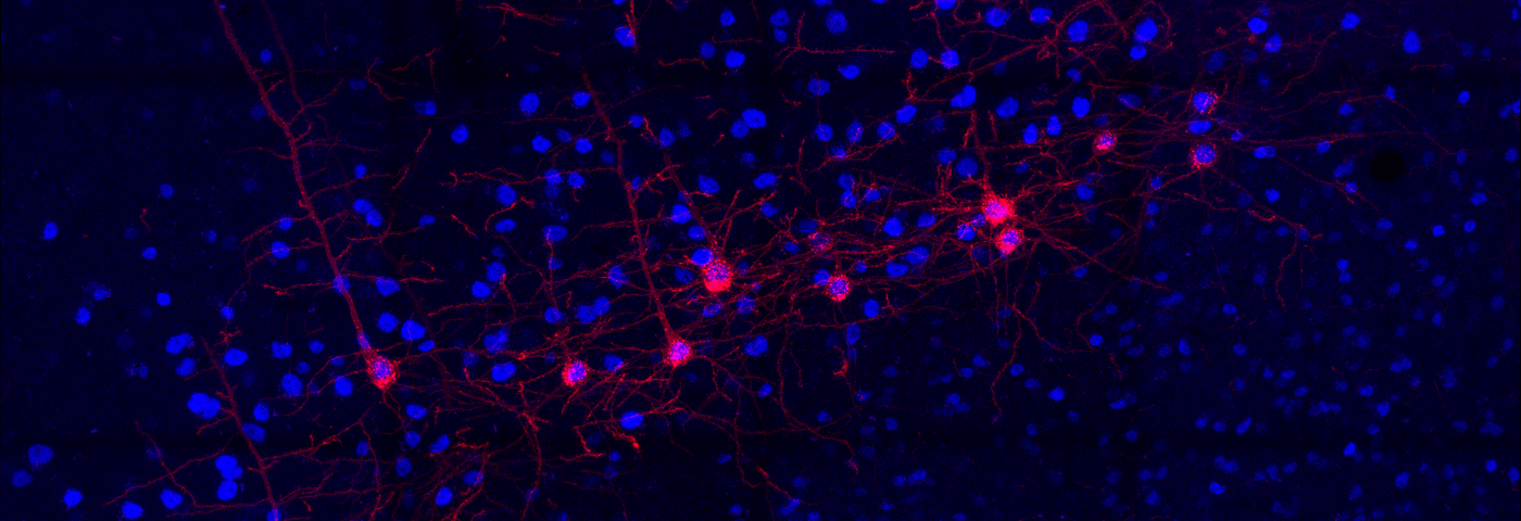 Microscope image showing brain motor neurons