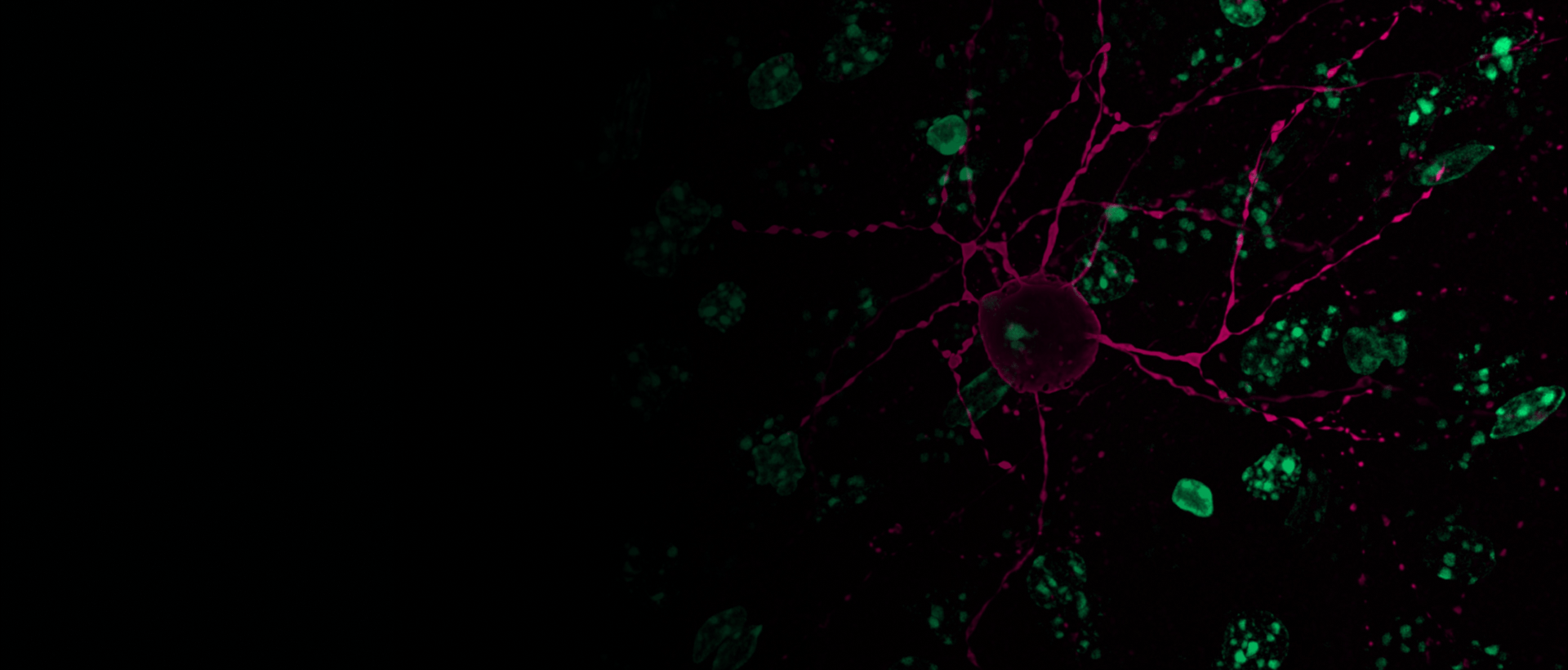 Advancing brain research