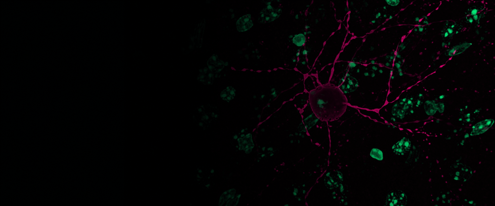 Advancing-brain-research