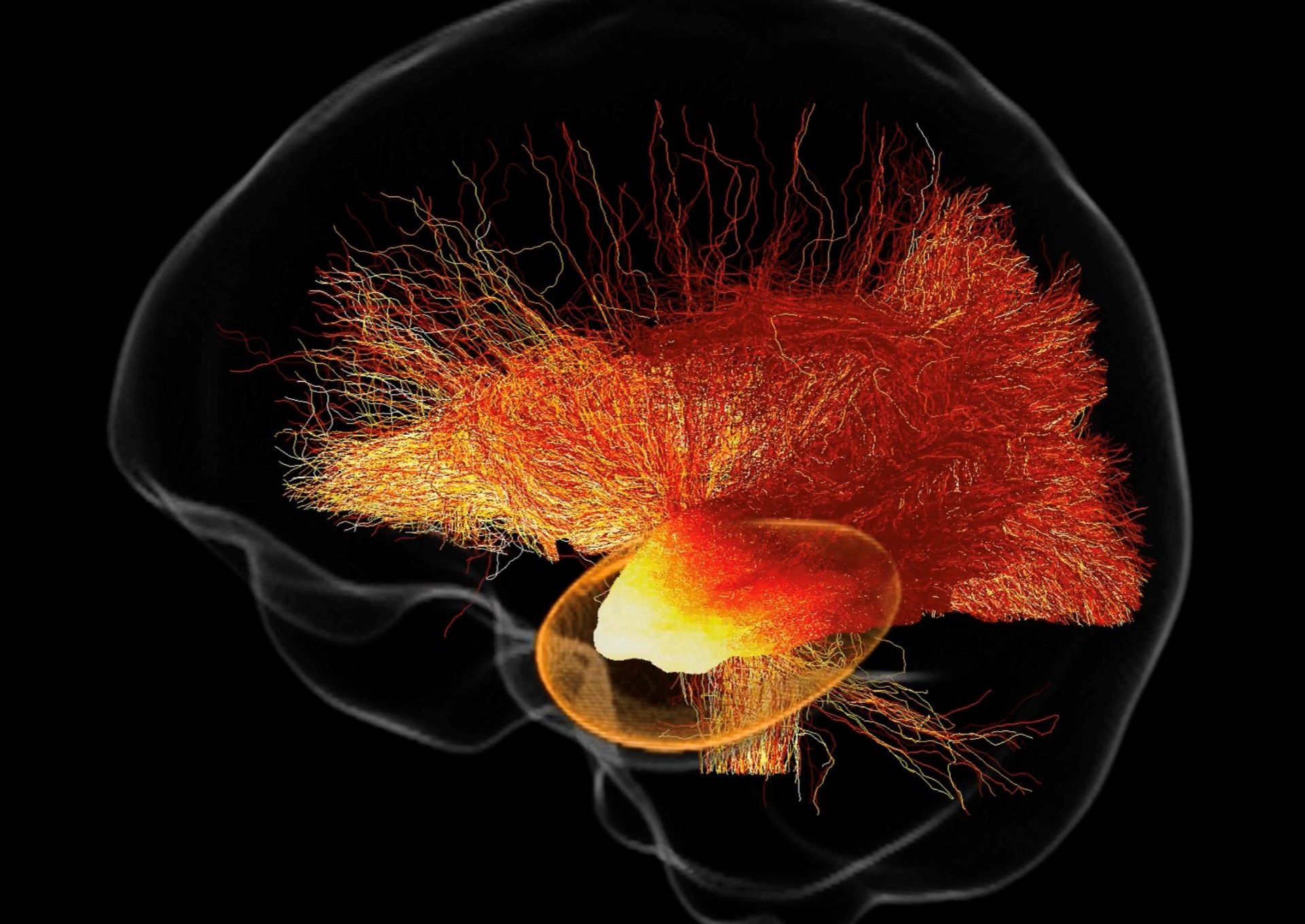 Brain scan