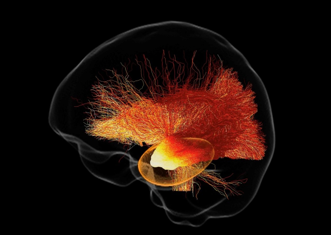 Brain scan images shows neurological connections lit up in bright colours