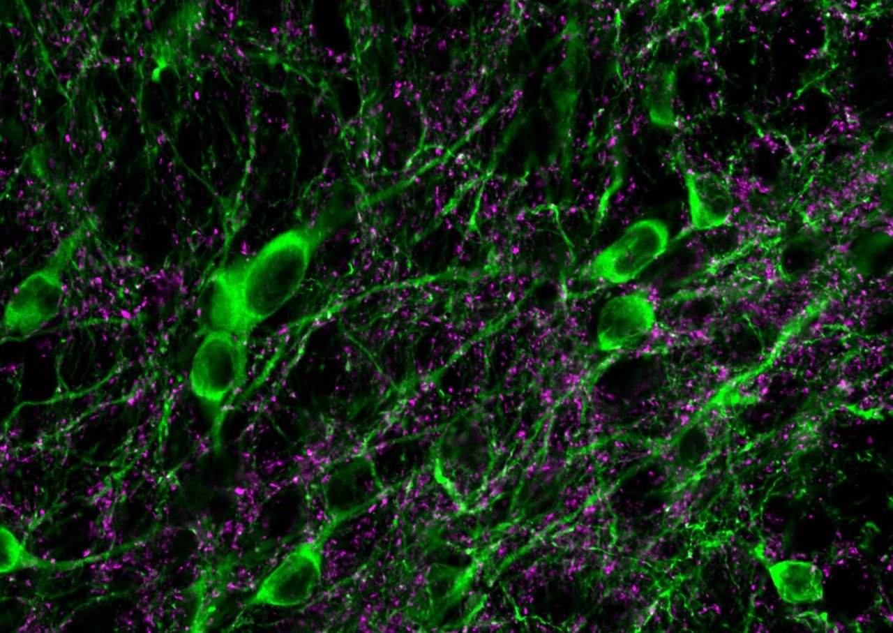 Neurons under a microscope