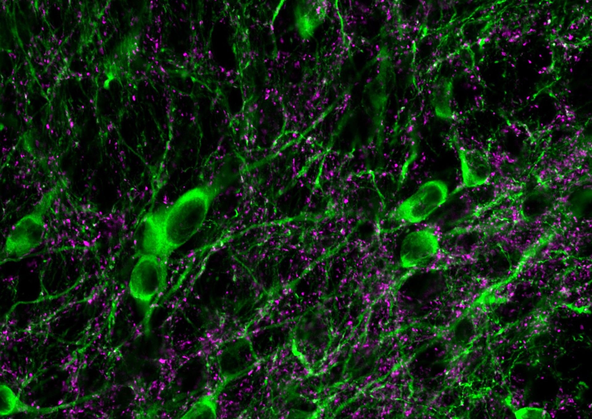Microscopic image of cells in the brain