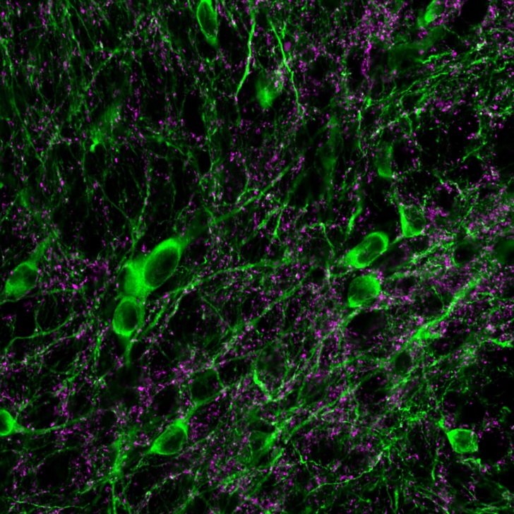 Microscopic image of cells in the brain