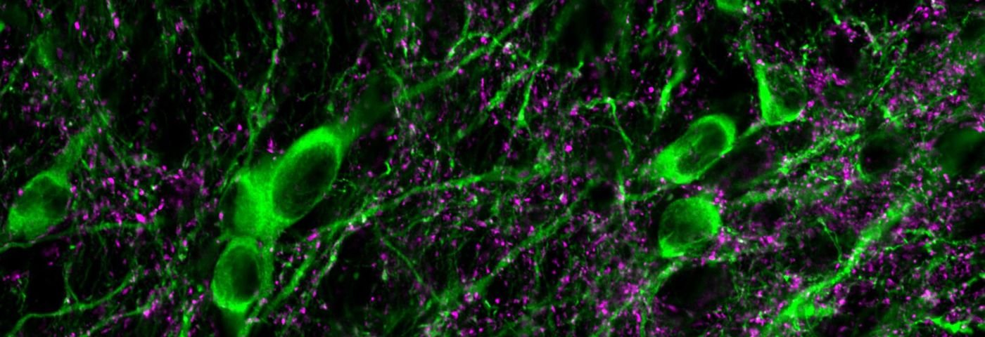 Dopamine cells in brain
