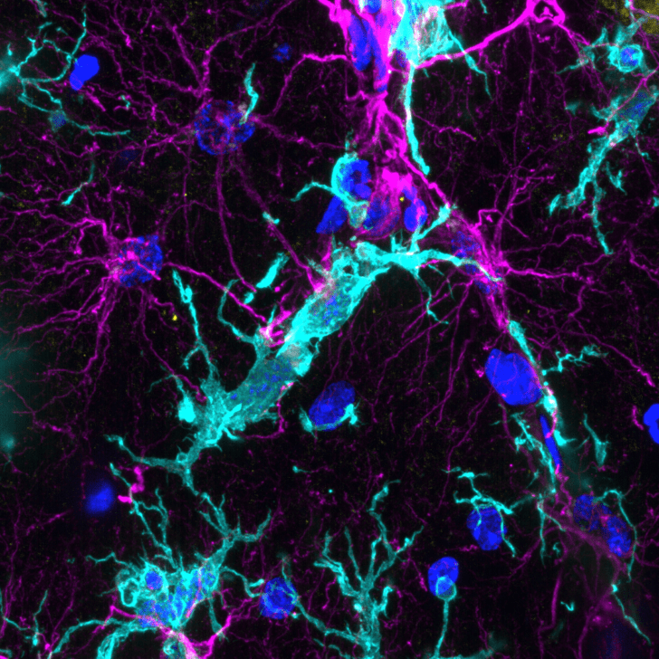 Microglial convergence