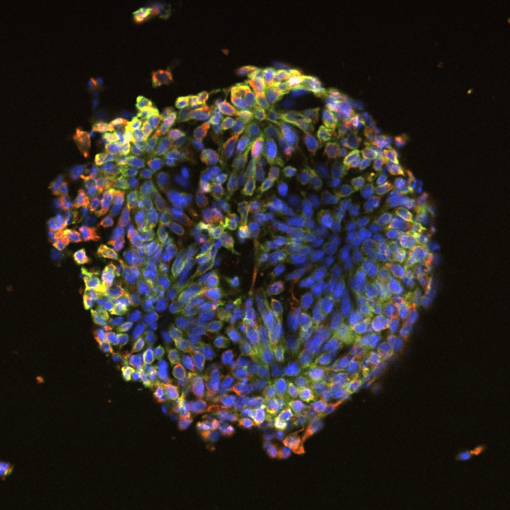 Neurogenesis in bloom