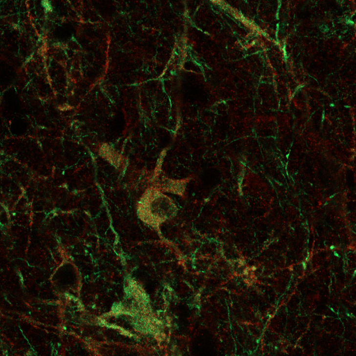 Neuronal forest