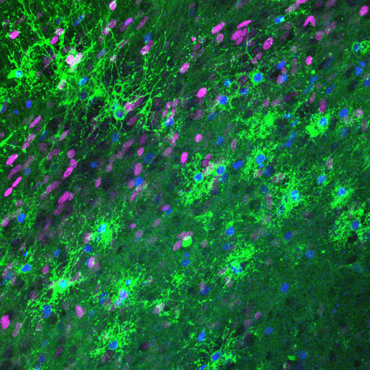 Paint Splatter Brain